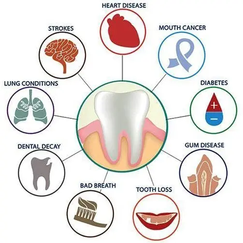 effects of periodontitis | periodontist Ellicott City, MD